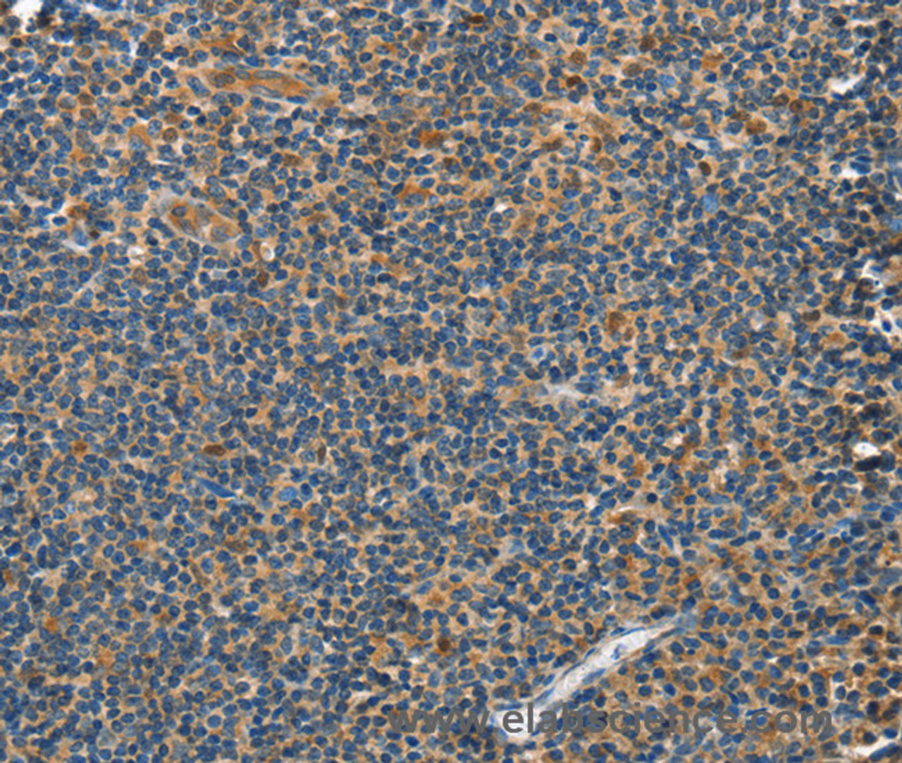 Immunohistochemistry of paraffin-embedded Human tonsil tissue using GRB7 Polyclonal Antibody at dilution 1:40