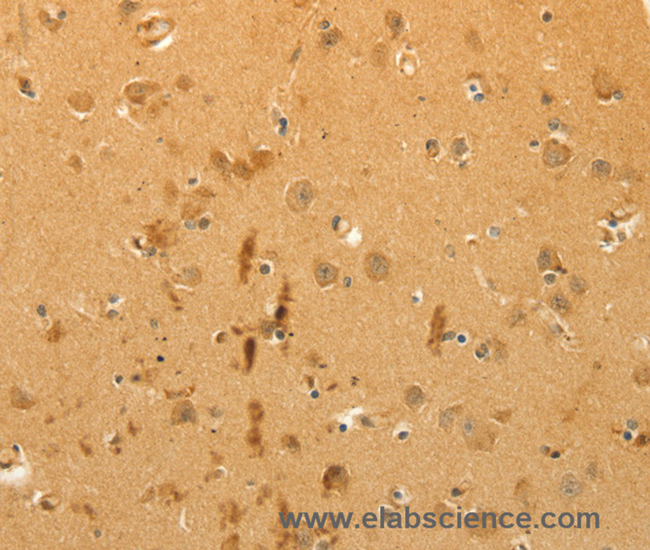 Immunohistochemistry of paraffin-embedded Human brain using CFHR1 Polyclonal Antibody at dilution of 1:40