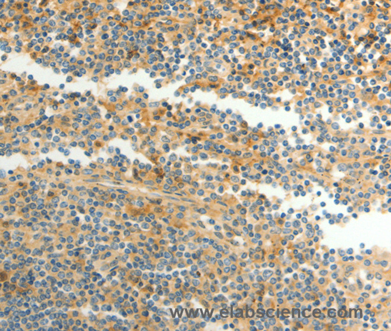 Immunohistochemistry of paraffin-embedded Human tonsil using CFHR1 Polyclonal Antibody at dilution of 1:40