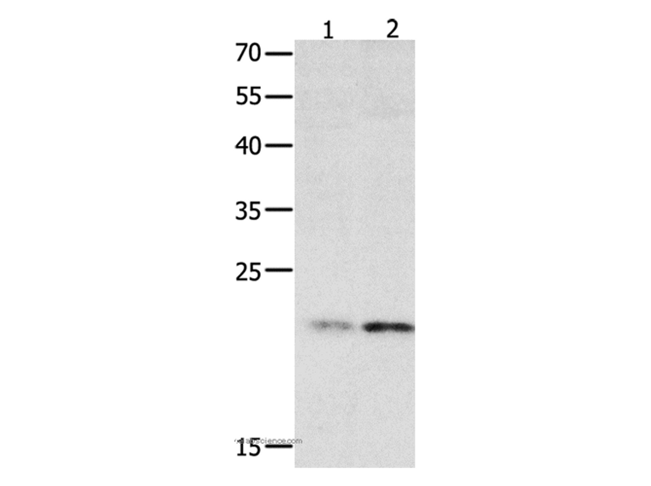 Western Blot analysis of 231 cell and Human fetal liver tissue using HMGB4 Polyclonal Antibody at dilution of 1:500