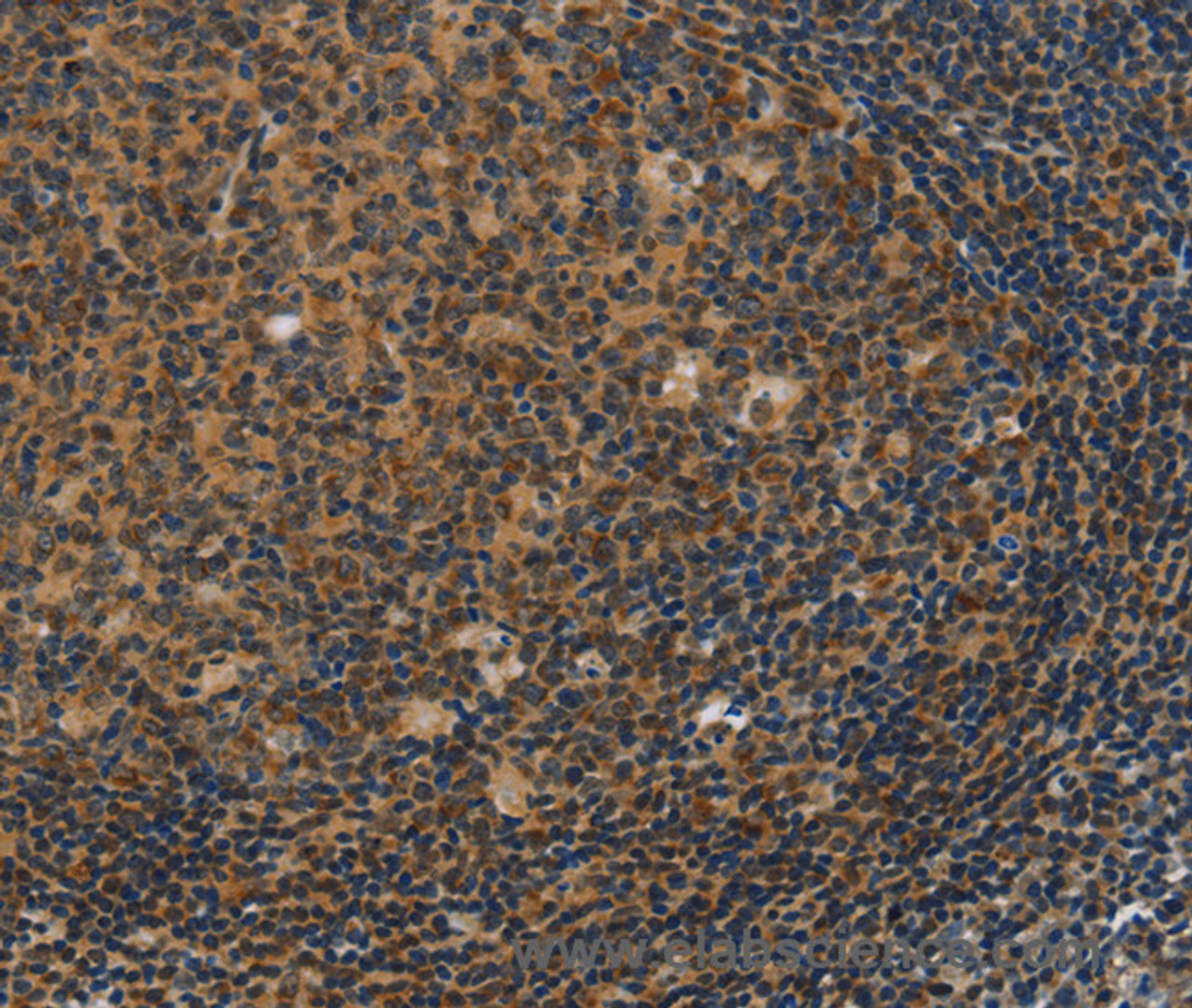 Immunohistochemistry of paraffin-embedded Human tonsil using IRF9 Polyclonal Antibody at dilution of 1:50
