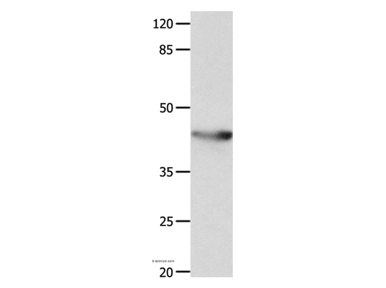 Western Blot analysis of Mouse spleen tissue using KCNA5 Polyclonal Antibody at dilution of 1:700