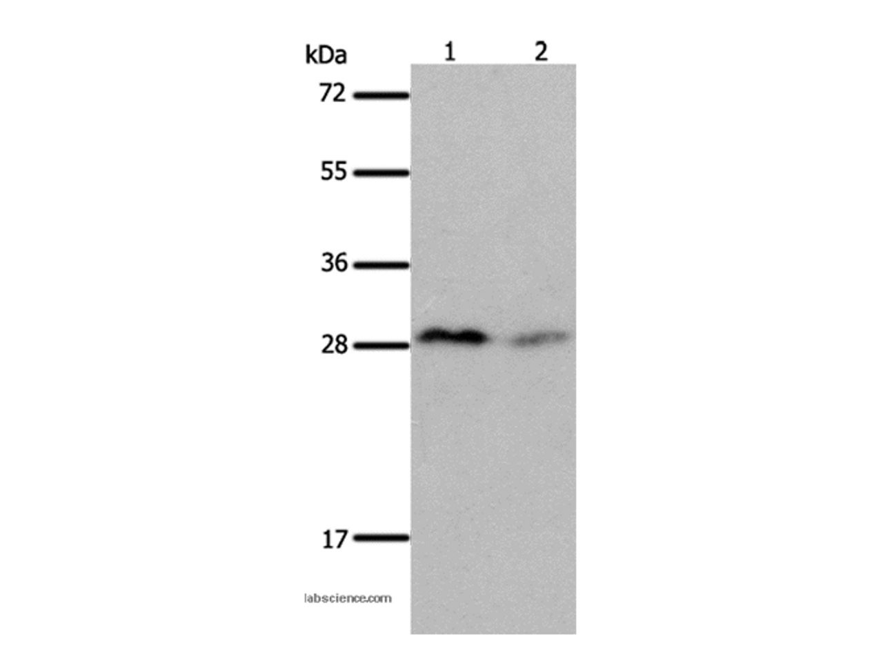 Western Blot analysis of Mouse brain and kidney tissue using KLK7 Polyclonal Antibody at dilution of 1:600