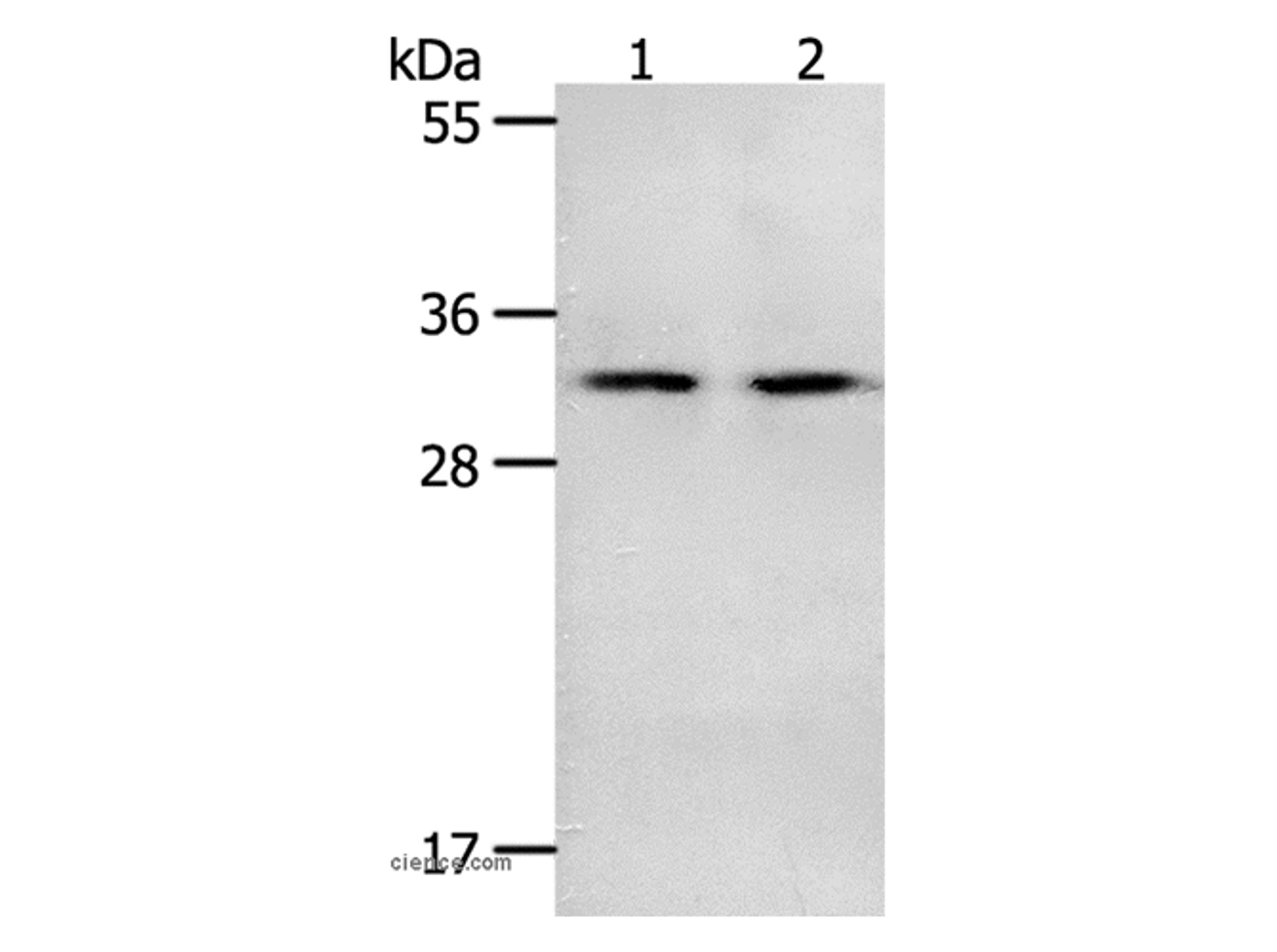 Western Blot analysis of Mouse spleen and intestinum crassum tissue using NME6 Polyclonal Antibody at dilution of 1:400