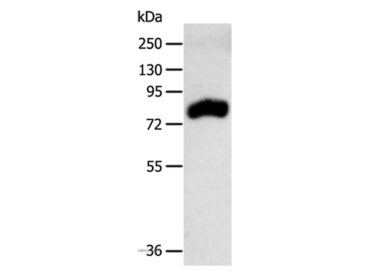 Western Blot analysis of Mouse kidney tissue using RPAP3 Polyclonal Antibody at dilution of 1:400