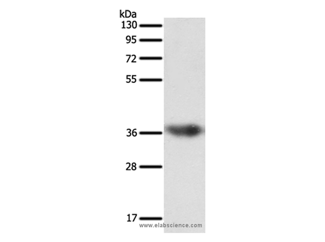 Western Blot analysis of Human liver cancer tissue using SULT1E1 Polyclonal Antibody at dilution of 1:500