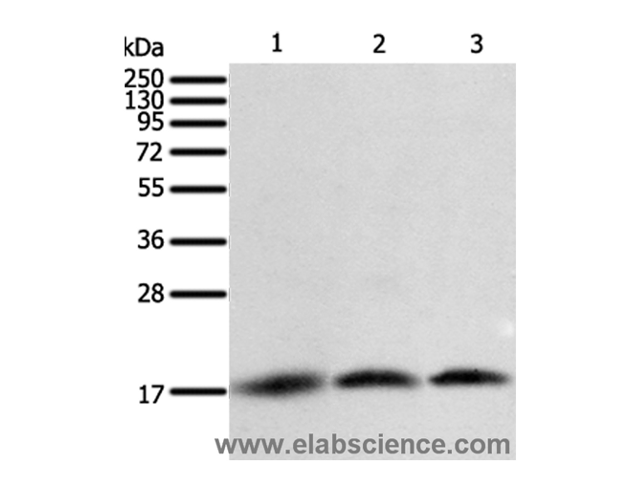 Western Blot analysis of A431, Jurkat and hela cell using Survivin Polyclonal Antibody at dilution of 1:400