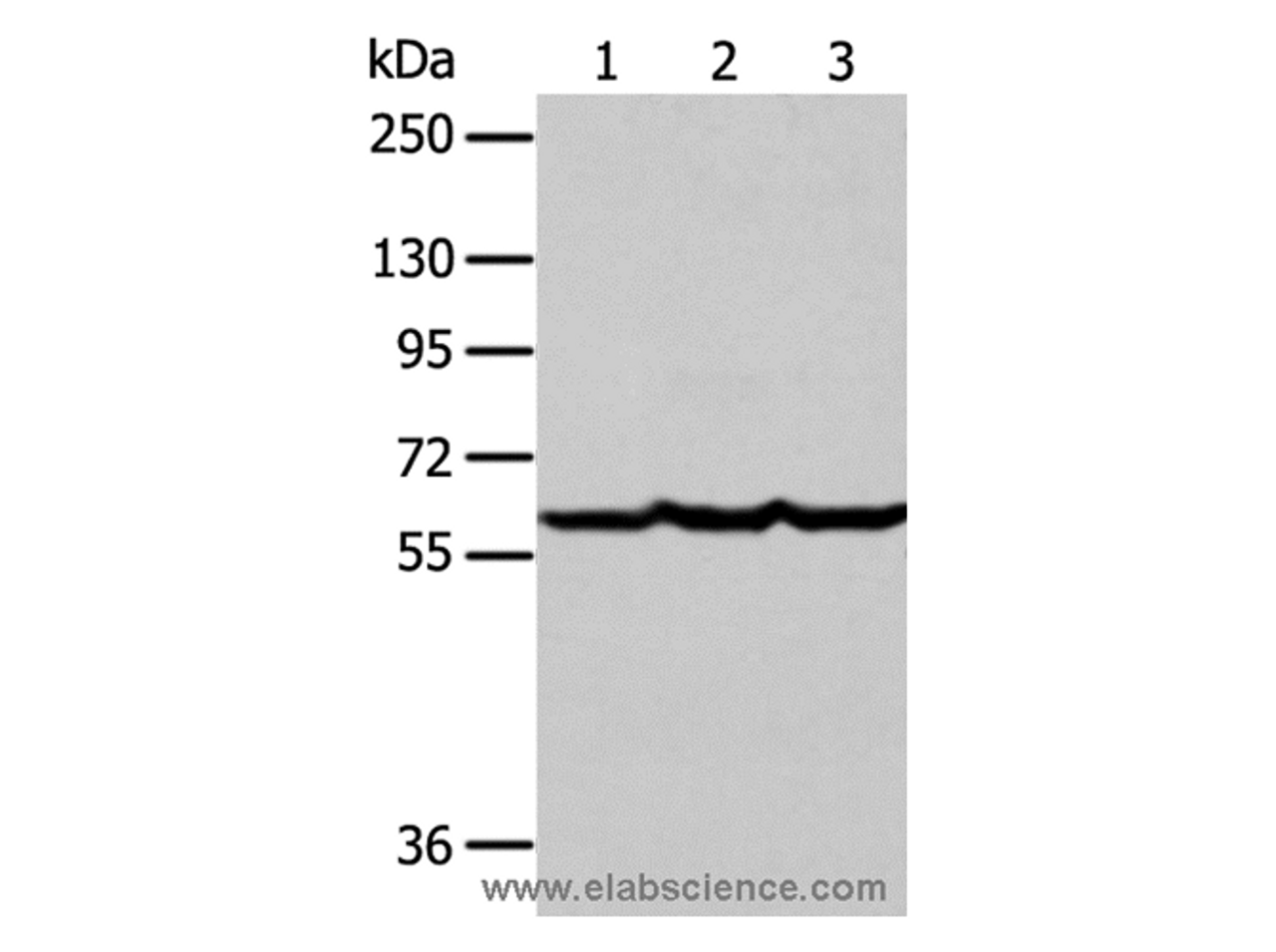 Western Blot analysis of Human liver cancer tissue, hela and Jurkat cell  using Factor IX Polyclonal Antibody at dilution of 1:400