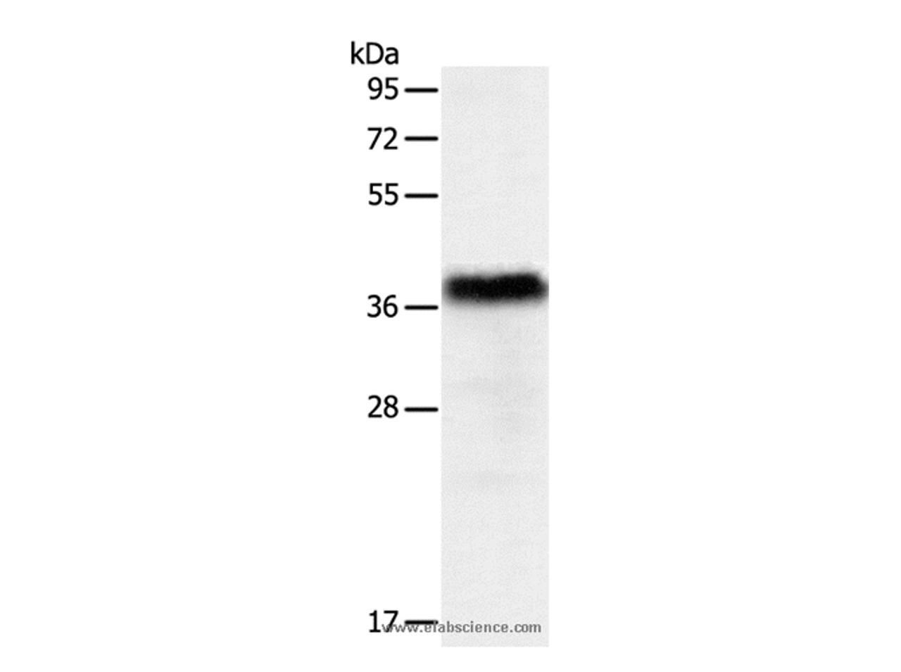 Western Blot analysis of Human liver cancer tissue using PGBD2 Polyclonal Antibody at dilution of 1:550