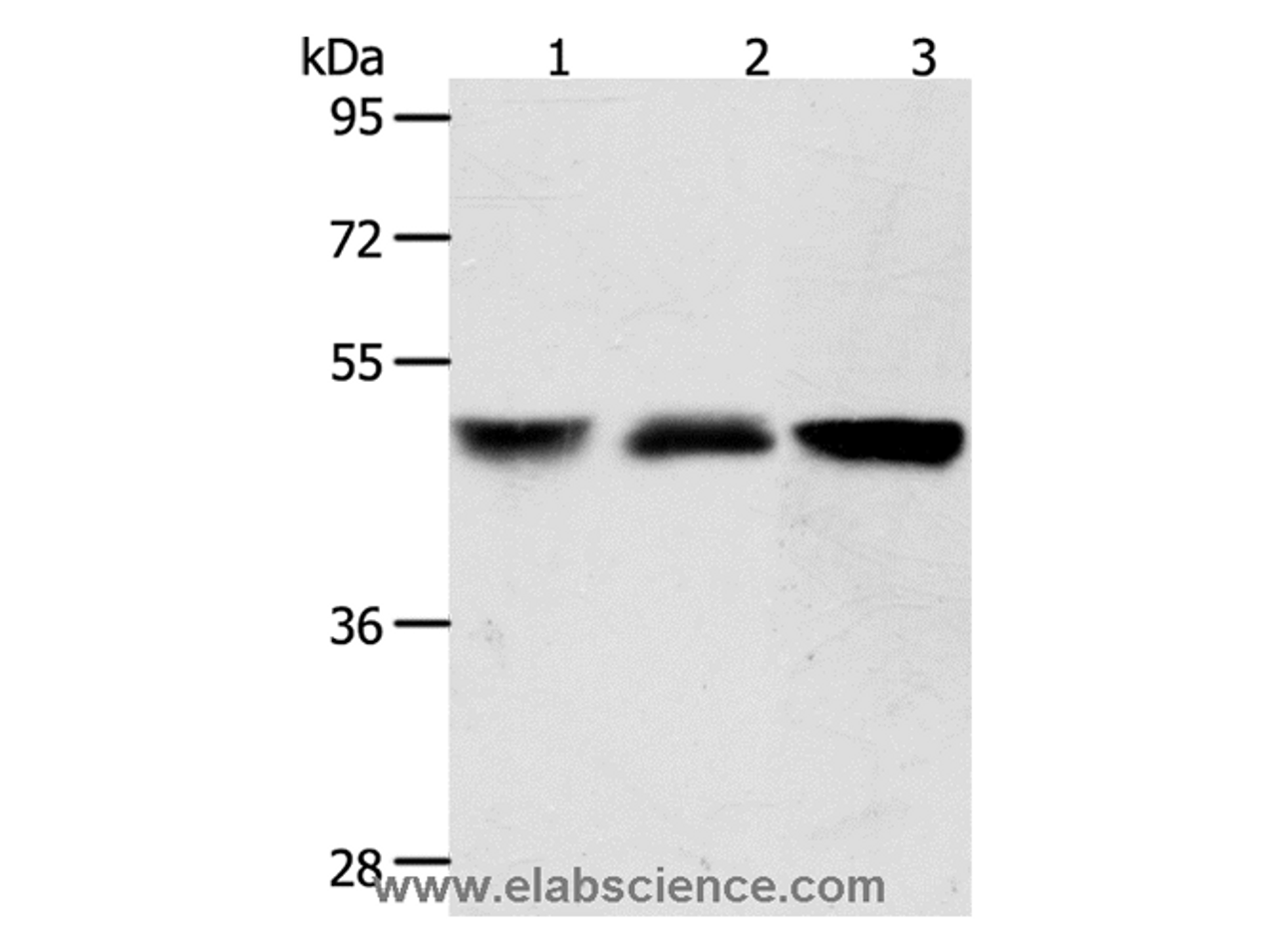 Western Blot analysis of Human brain malignant glioma and Human fetal kidney tissue, A172 cell using ACOT9 Polyclonal Antibody at dilution of 1:600