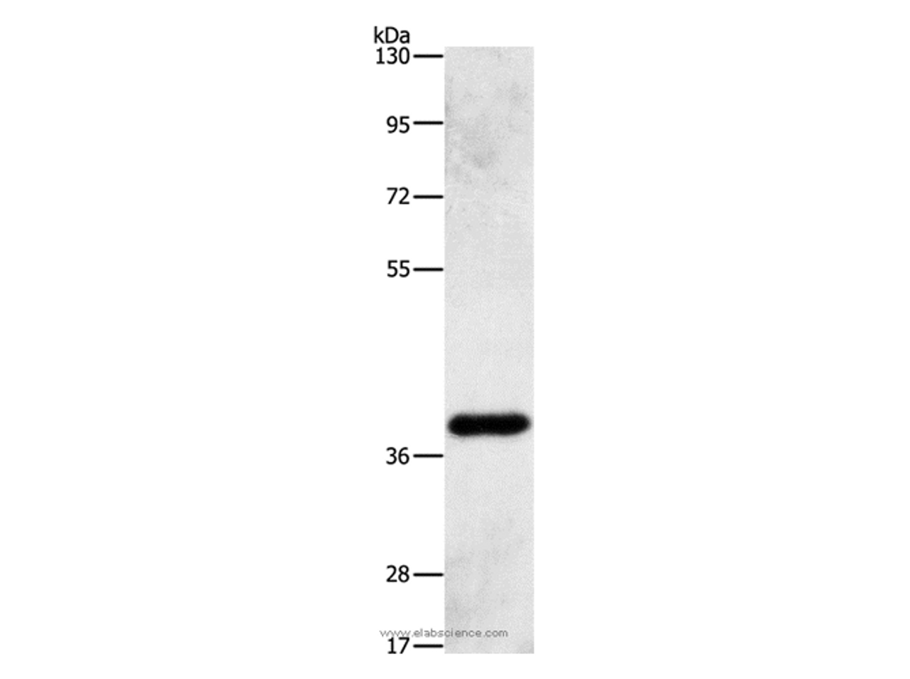 Western Blot analysis of Human fetal liver tissue using AMPK gamma1 Polyclonal Antibody at dilution of 1:500