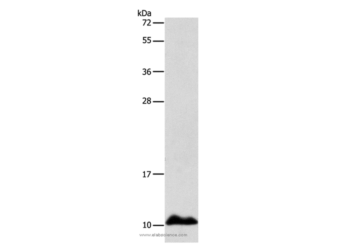 Western Blot analysis of Human fetal liver tissue using APOC1 Polyclonal Antibody at dilution of 1:500