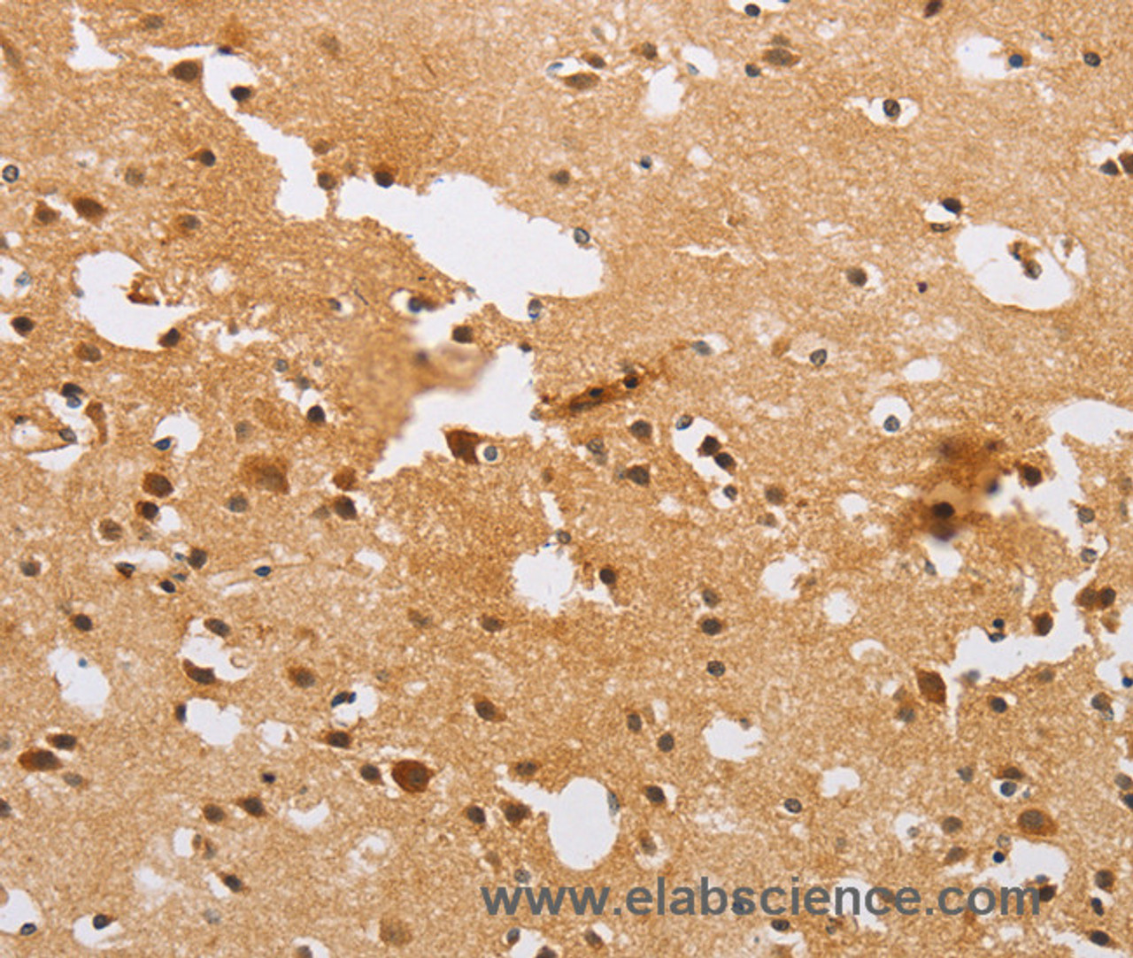 Immunohistochemistry of paraffin-embedded Human brain  tissue using ACTR2 Polyclonal Antibody at dilution 1:40