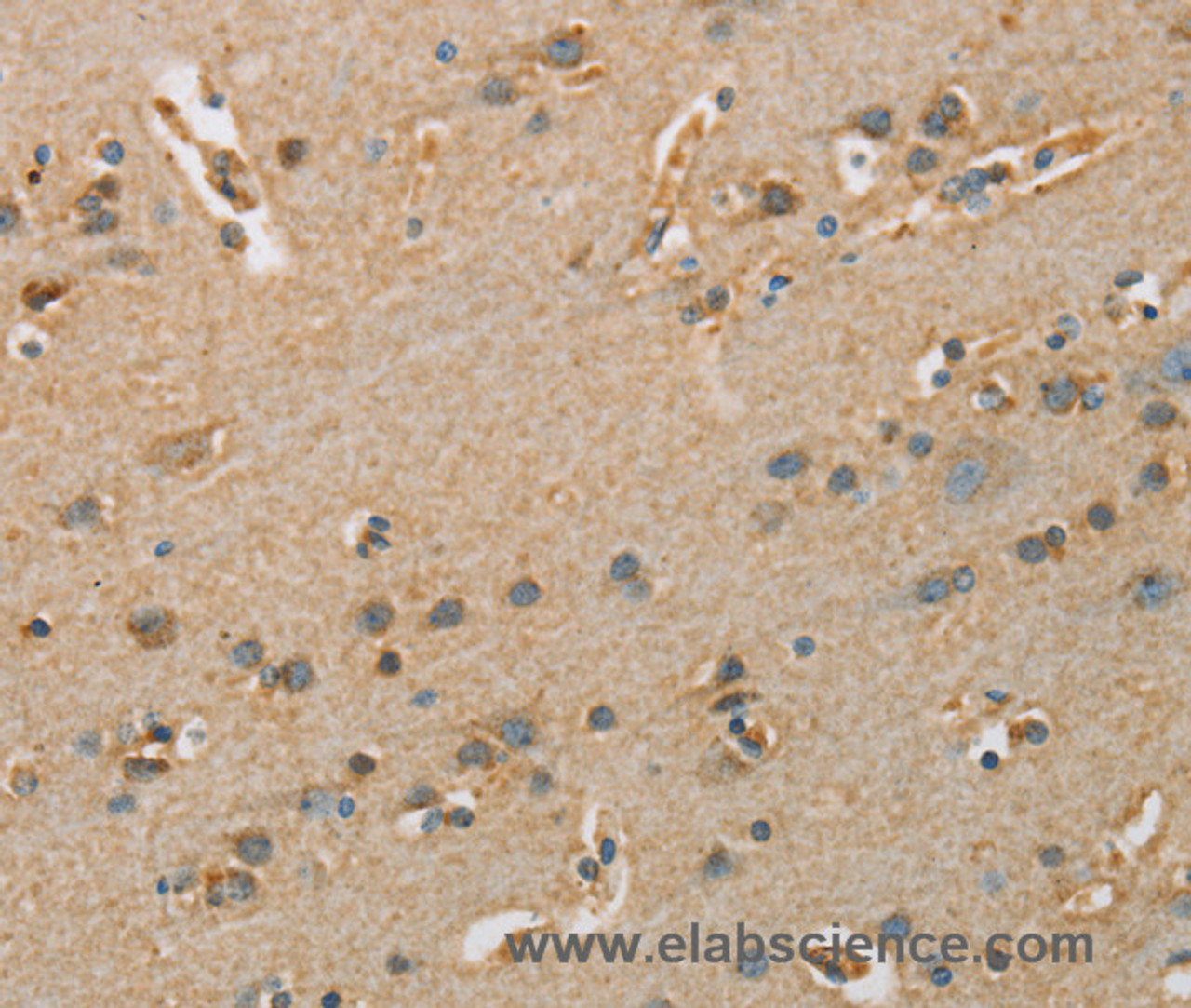 Immunohistochemistry of paraffin-embedded Human brain  tissue using ARSA Polyclonal Antibody at dilution 1:50