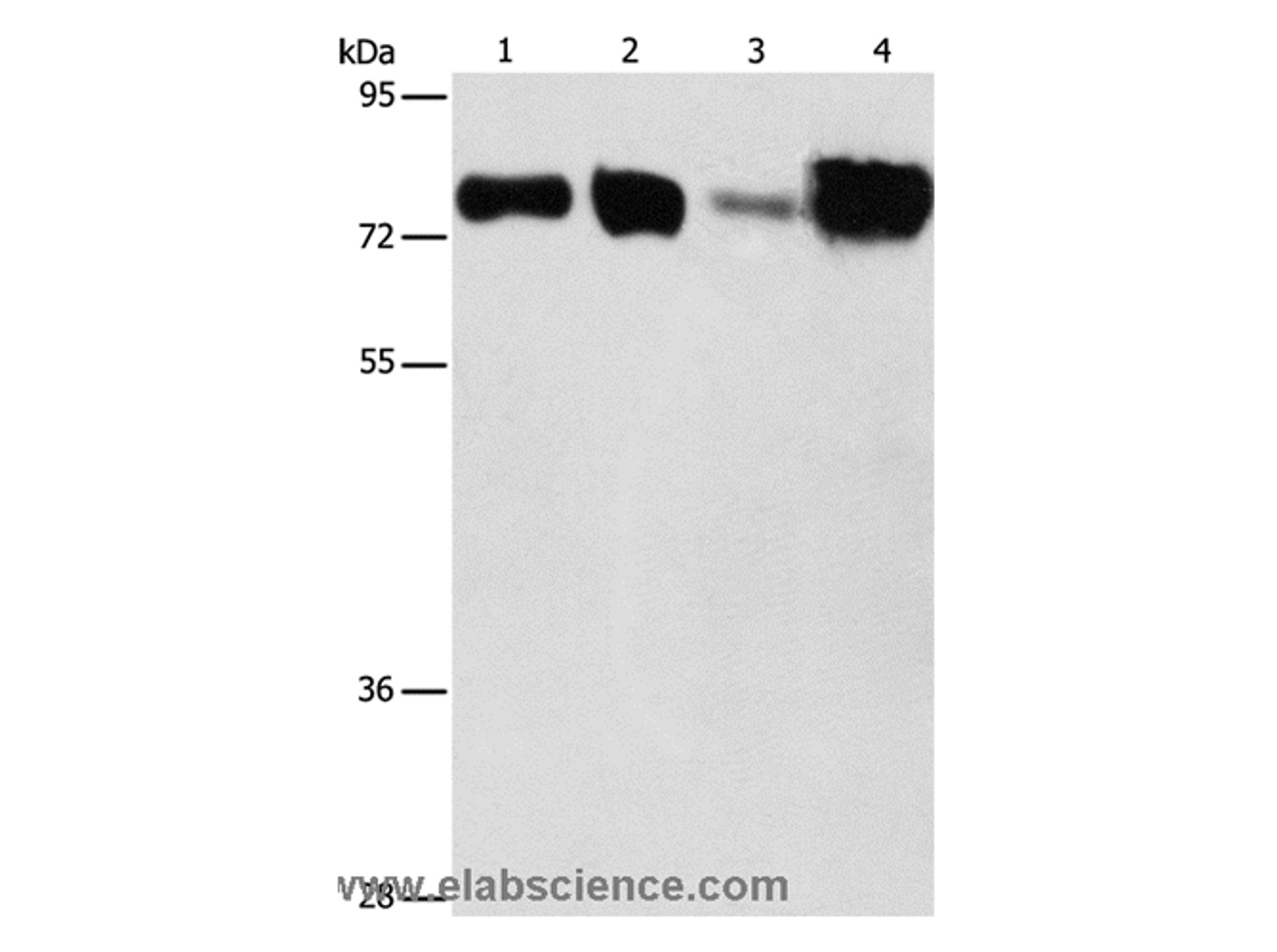 Western Blot analysis of Hepg2 and hela cell, Human fetal kidney and liver tissue using ACSL4 Polyclonal Antibody at dilution of 1:650