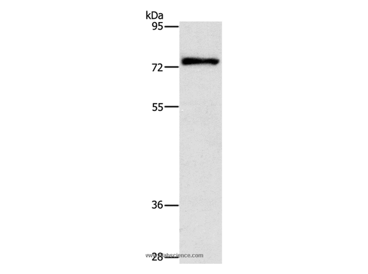 Western Blot analysis of Mouse brain tissue using PKC delta Polyclonal Antibody at dilution of 1:350
