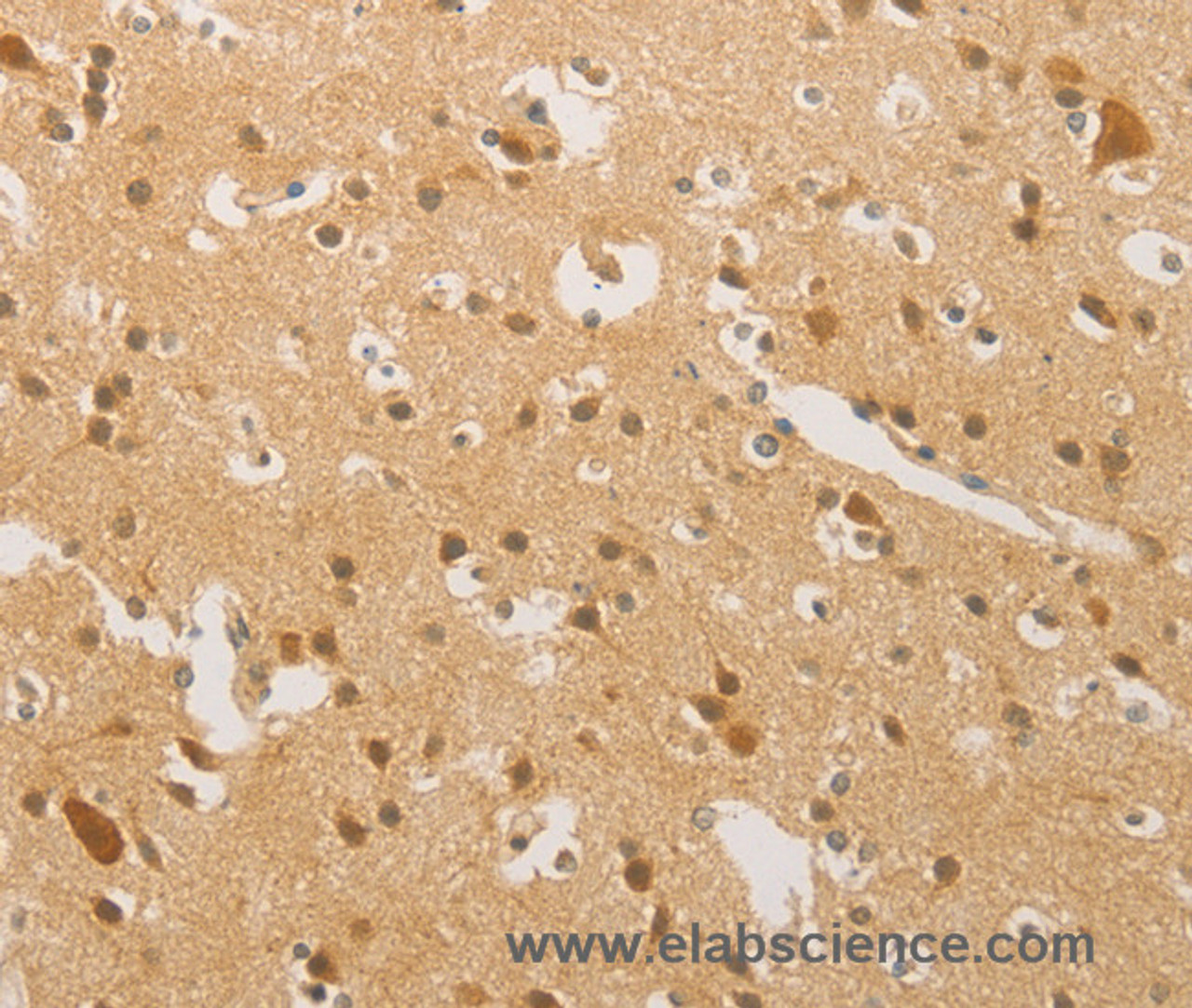 Immunohistochemistry of paraffin-embedded Human brain  tissue using HIPK4 Polyclonal Antibody at dilution 1:30