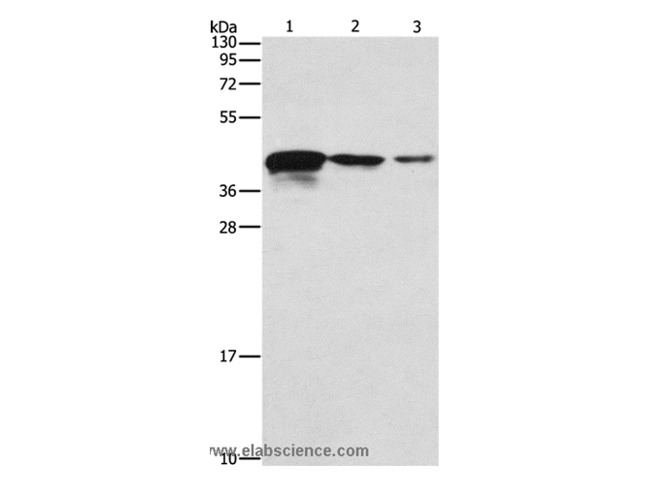 Western Blot analysis of Human endometrial carcinoma tissue, A172 and U937 cell using TWF2 Polyclonal Antibody at dilution of 1:800