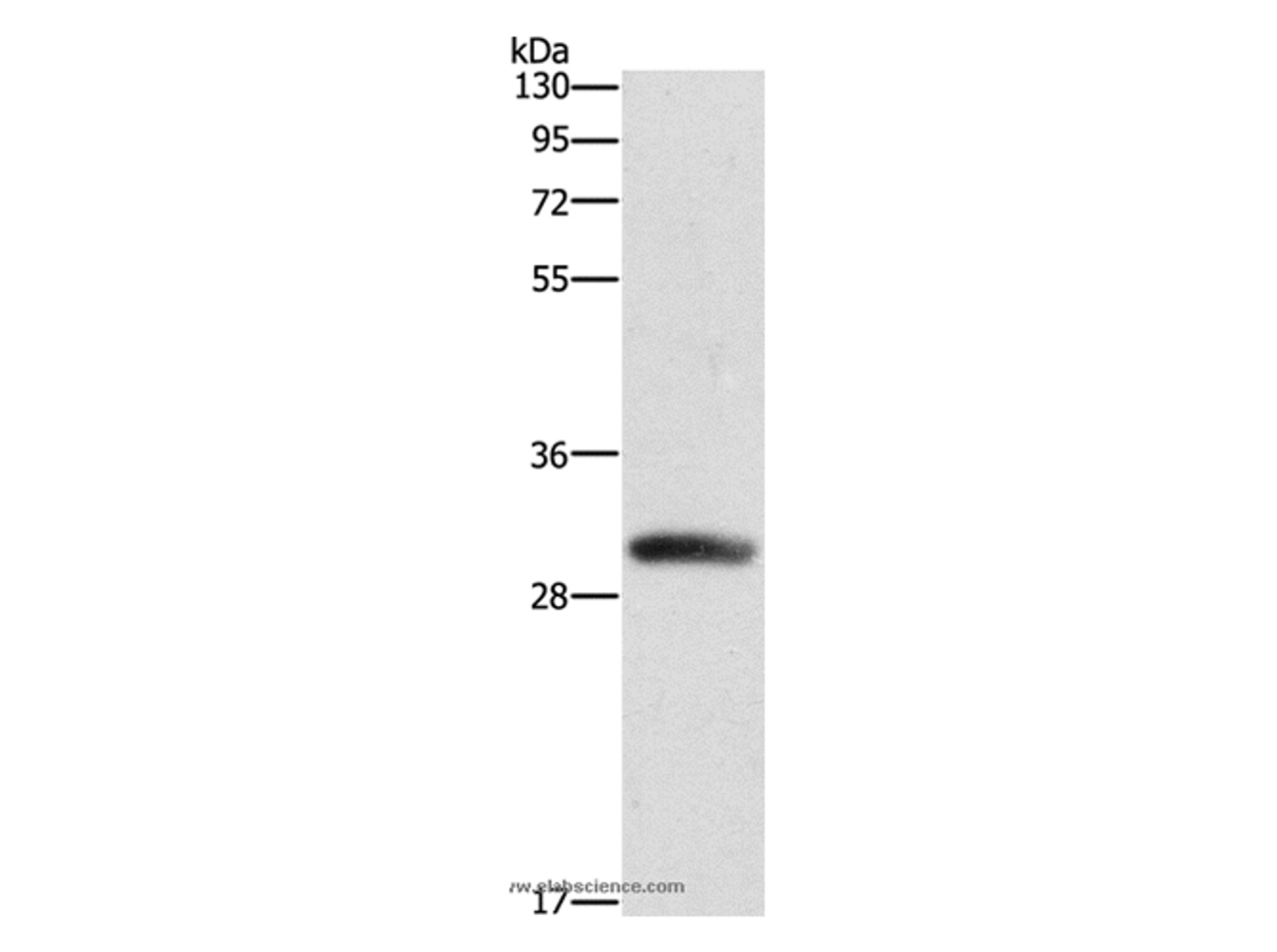 Western Blot analysis of Mouse heart tissue using DCK Polyclonal Antibody at dilution of 1:550