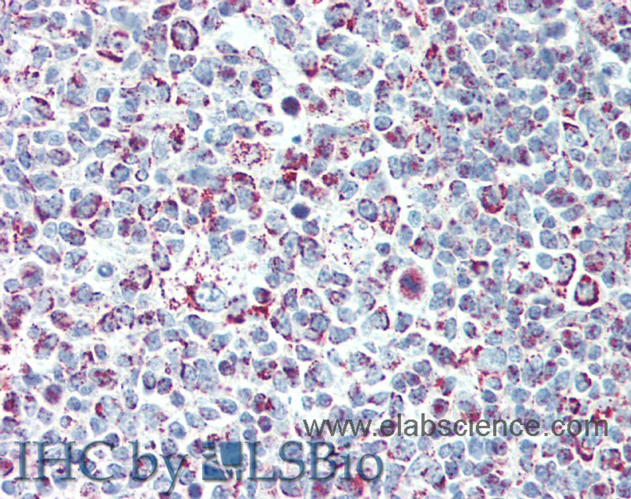 Immunohistochemistry of paraffin-embedded Tonsil tissue using LTB Polyclonal Antibody at dilution of 1:90(Elabscience® Product Detected by Lifespan).