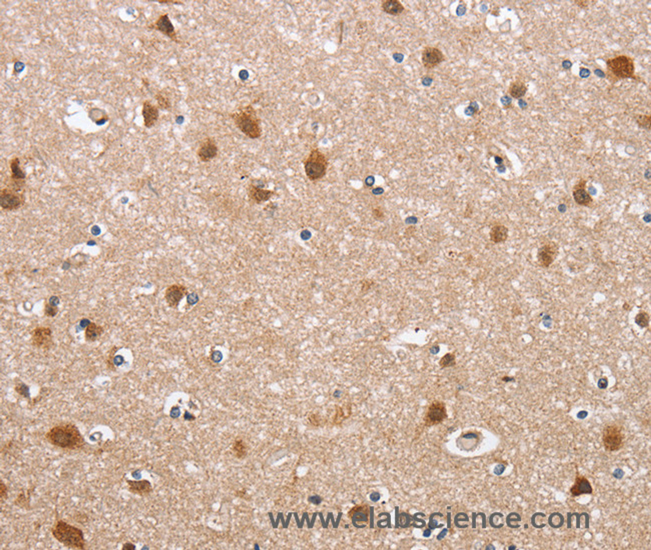 Immunohistochemistry of paraffin-embedded Human brain tissue using DEFA6 Polyclonal Antibody at dilution 1:40