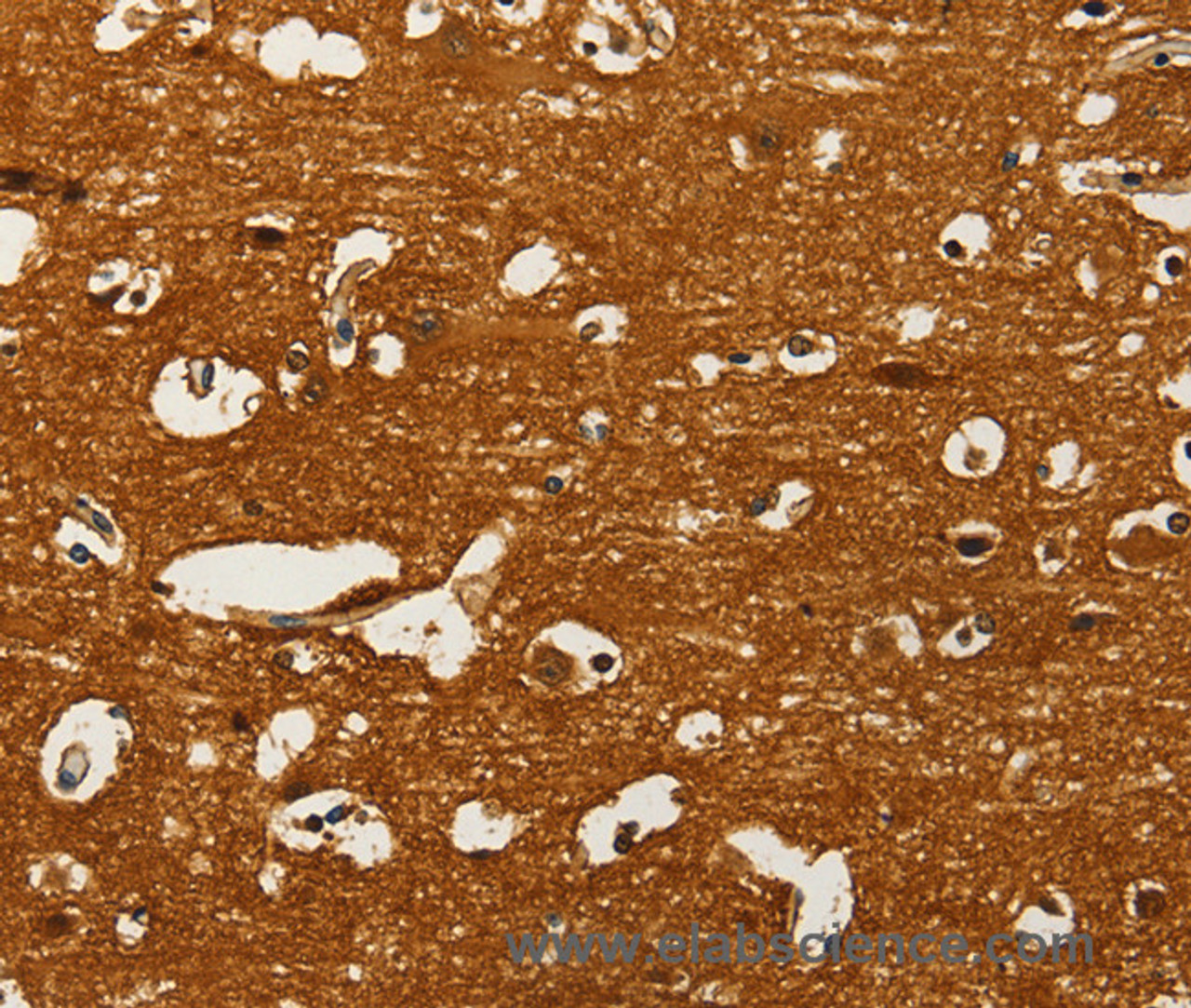 Immunohistochemistry of paraffin-embedded Human brain  using GOT1 Polyclonal Antibody at dilution of 1:50