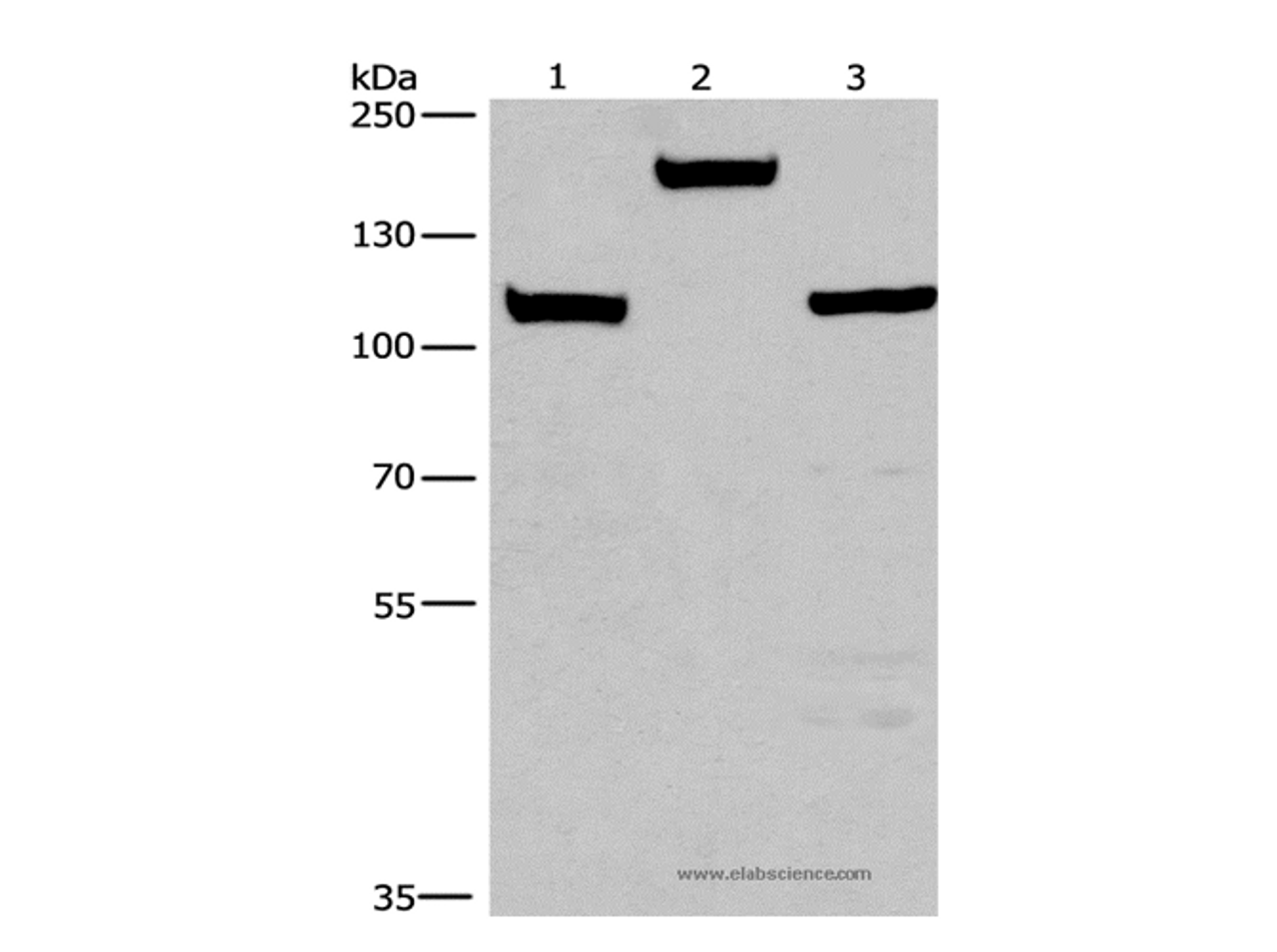 Western Blot analysis of Mouse kidney tissue, 293T and 231 cell using TP53BP2 Polyclonal Antibody at dilution of 1:375