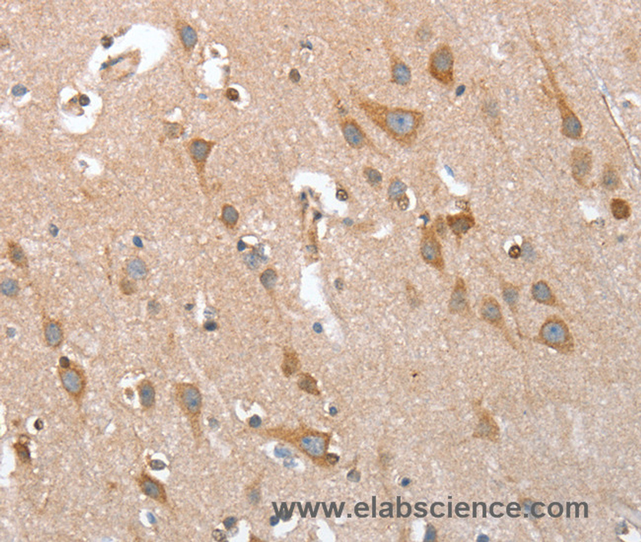 Immunohistochemistry of paraffin-embedded Human brain  using TP53BP2 Polyclonal Antibody at dilution of 1:35