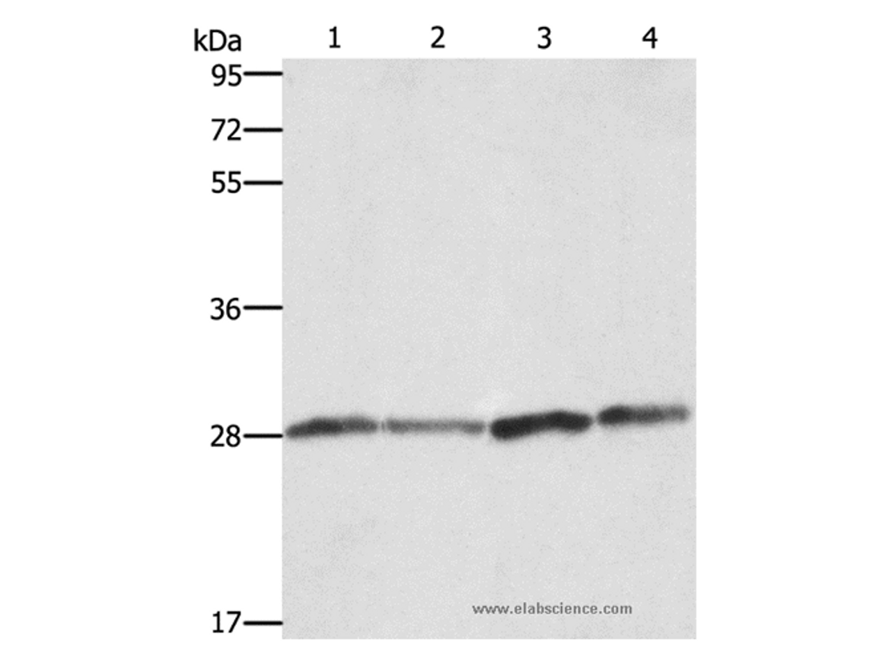 Western Blot analysis of Human placenta tissue and A549 cell, Raji and hela cell using BCAP31 Polyclonal Antibody at dilution of 1:750