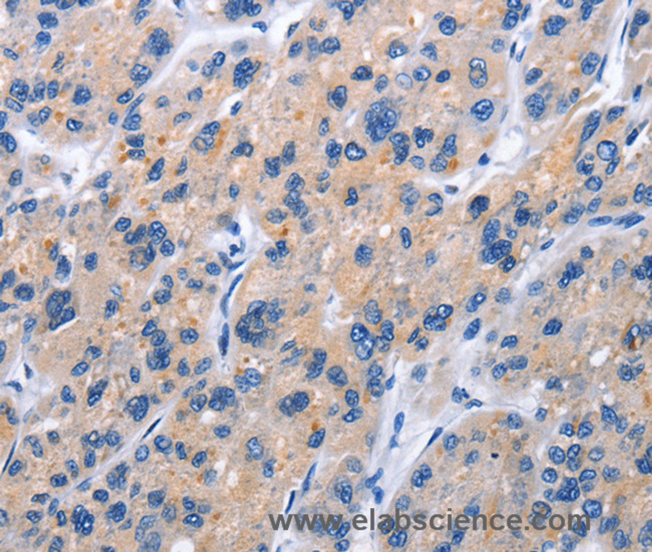 Immunohistochemistry of paraffin-embedded Human brain tissue using CD137 Polyclonal Antibody at dilution 1:50