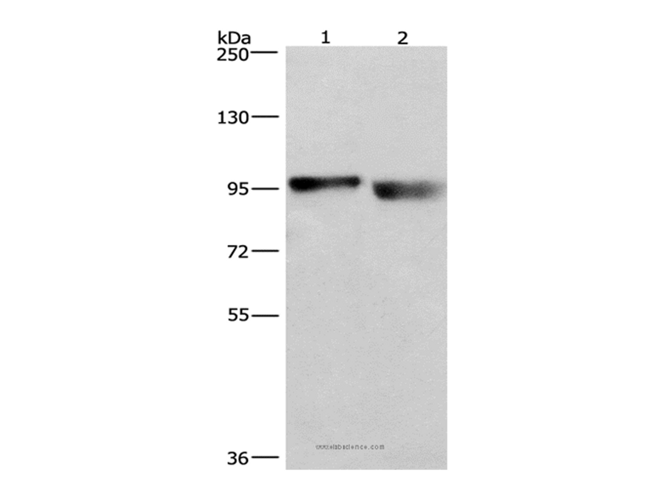 Western Blot analysis of A431 and lovo cell using KIAA1524 Polyclonal Antibody at dilution of 1:597