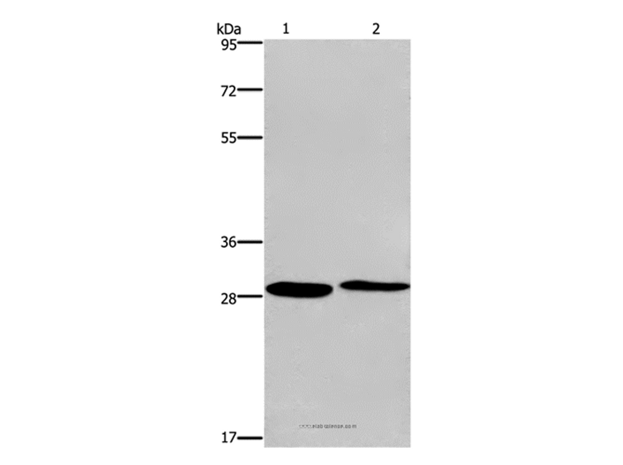 Western Blot analysis of Hela and 293T cell using CPSF4 Polyclonal Antibody at dilution of 1:400