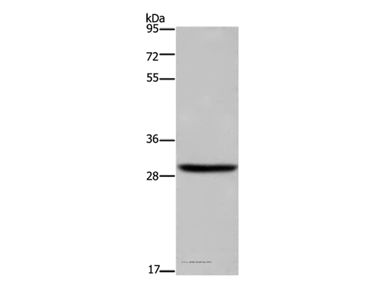 Western Blot analysis of A375 cell using DHRS3 Polyclonal Antibody at dilution of 1:600
