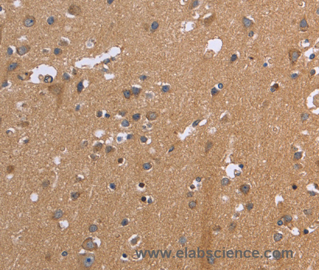 Immunohistochemistry of paraffin-embedded Human brain  tissue using KIAA1324 Polyclonal Antibody at dilution 1:30