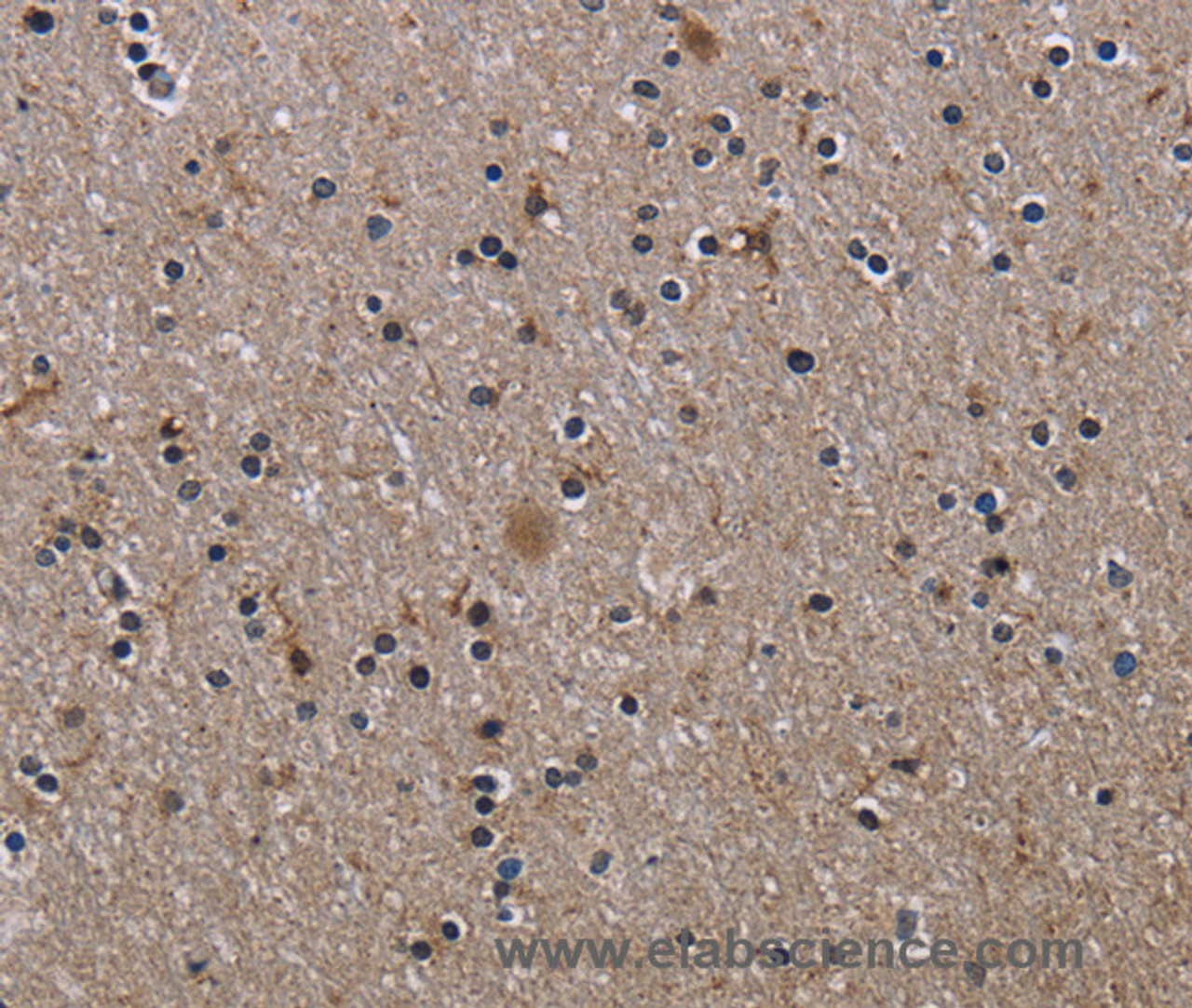 Immunohistochemistry of paraffin-embedded Human brain using ITGB2 Polyclonal Antibody at dilution of 1:50