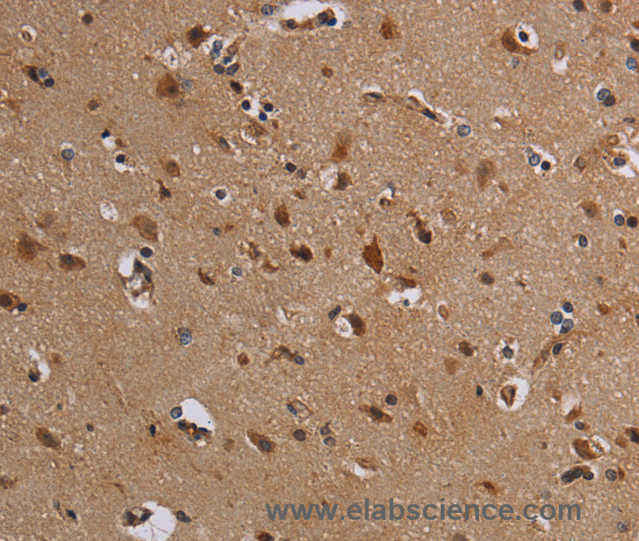 Immunohistochemistry of paraffin-embedded Human brain using KCNK13 Polyclonal Antibody at dilution of 1:50