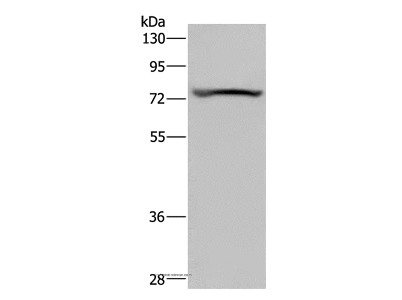 Western Blot analysis of Mouse heart tissue using KCNQ1 Polyclonal Antibody at dilution of 1:200