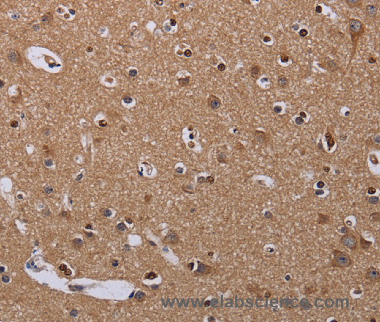 Immunohistochemistry of paraffin-embedded Human brain  using MCTS1 Polyclonal Antibody at dilution of 1:60