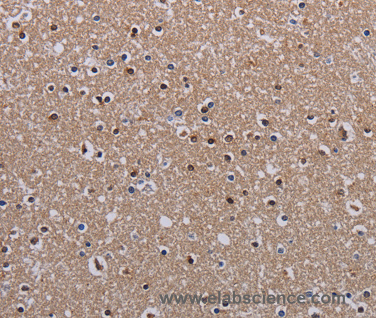 Immunohistochemistry of paraffin-embedded Human brain  using MECP2 Polyclonal Antibody at dilution of 1:60