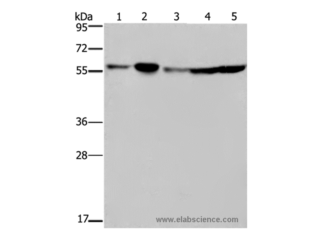 Western Blot analysis of Hela, 293T, A549, HT-29 and K562 cell using NUP50 Polyclonal Antibody at dilution of 1:200