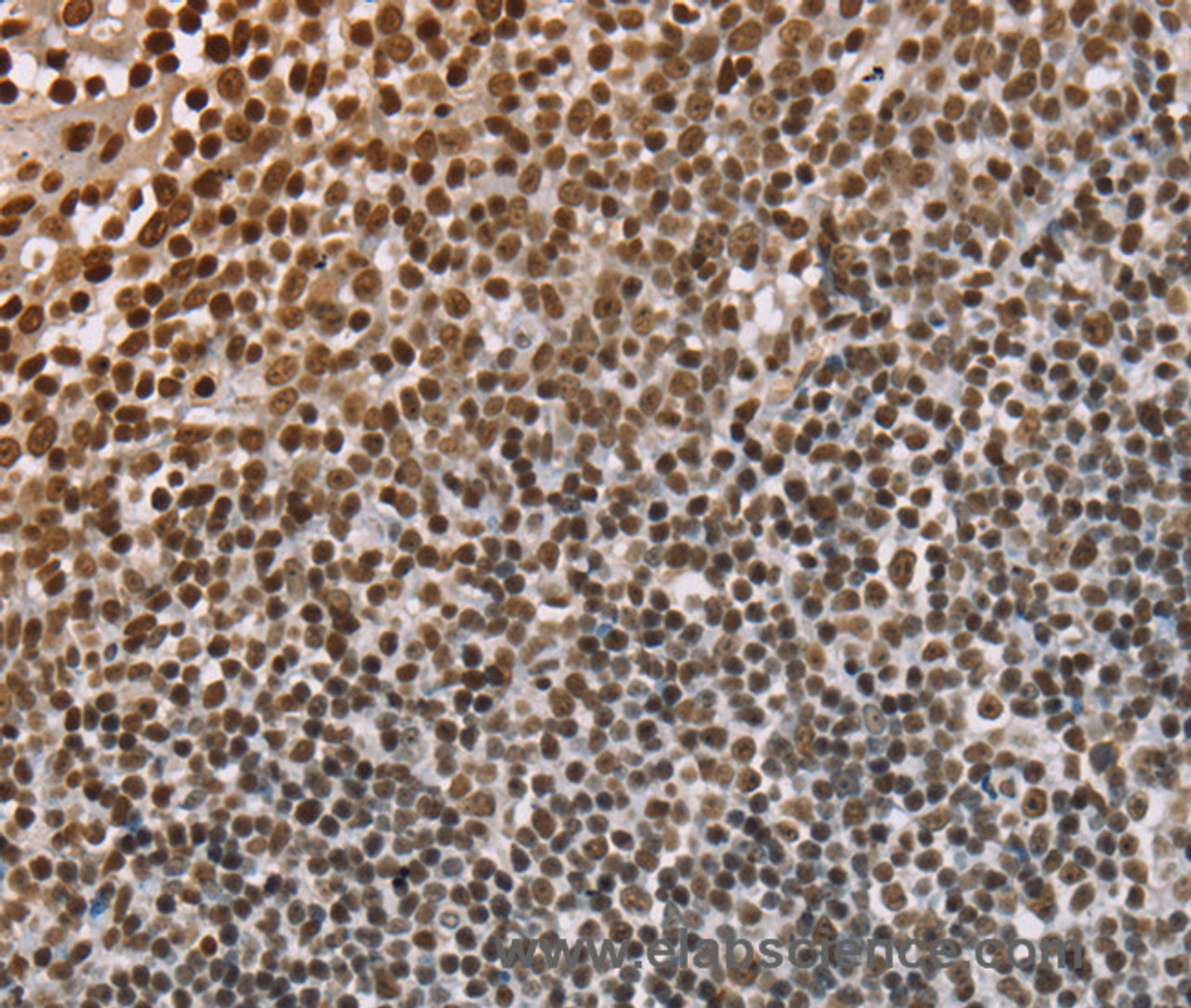 Immunohistochemistry of paraffin-embedded Human tonsil using NUP50 Polyclonal Antibody at dilution of 1:30