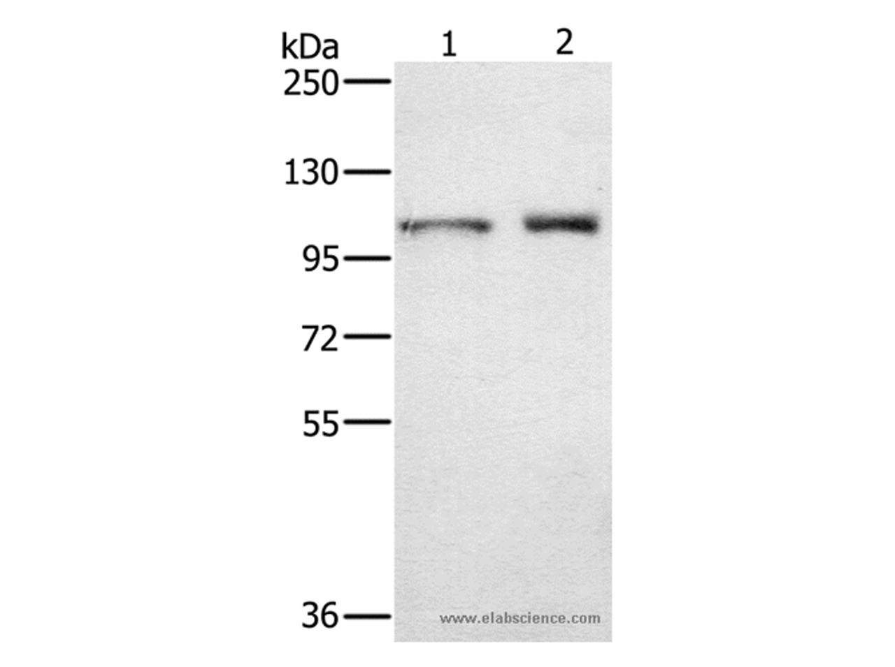 Western Blot analysis of  Human testis tissue and K562 cell using ODF2 Polyclonal Antibody at dilution of 1:650