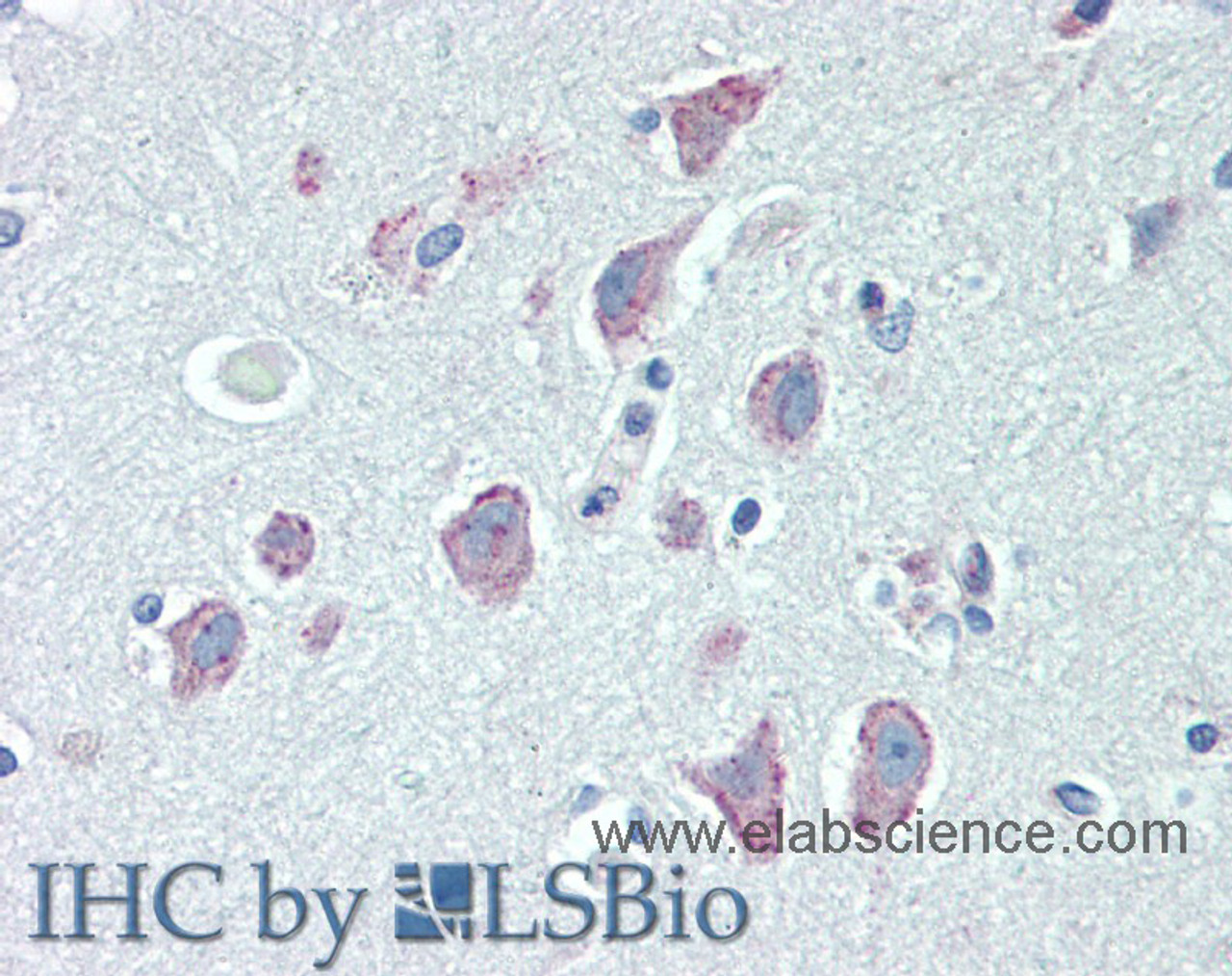Immunohistochemistry of paraffin-embedded Brain, Cortex tissue using RGS4 Polyclonal Antibody at dilution of 1:100(Elabscience® Product Detected by Lifespan).