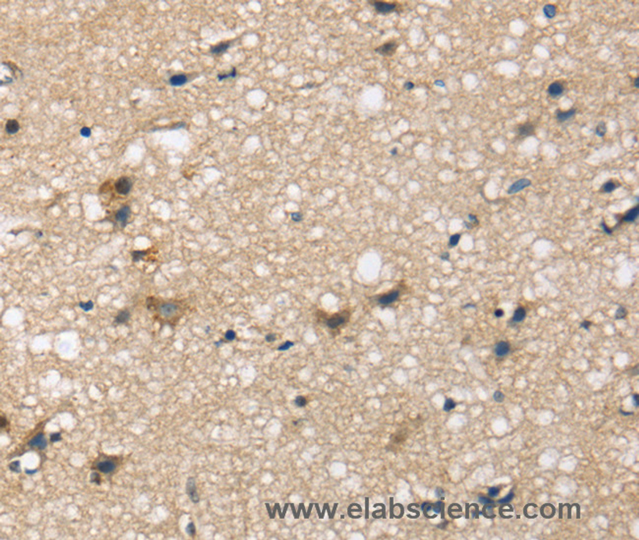 Immunohistochemistry of paraffin-embedded Human brain tissue using SEMA4A Polyclonal Antibody at dilution 1:45