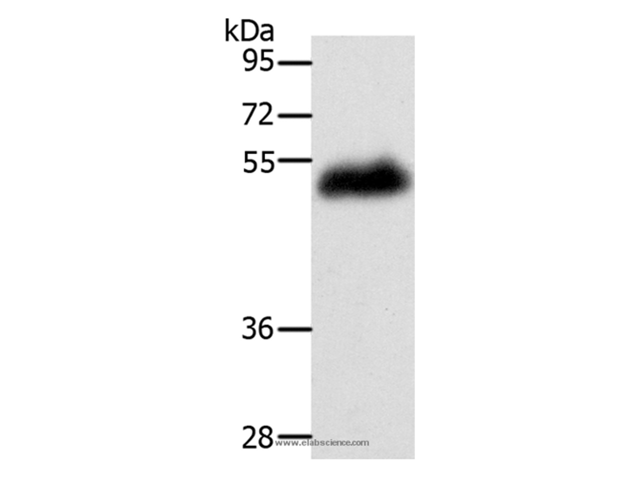 Western Blot analysis of Human leiomyosarcoma tissue using LOX Polyclonal Antibody at dilution of 1:400