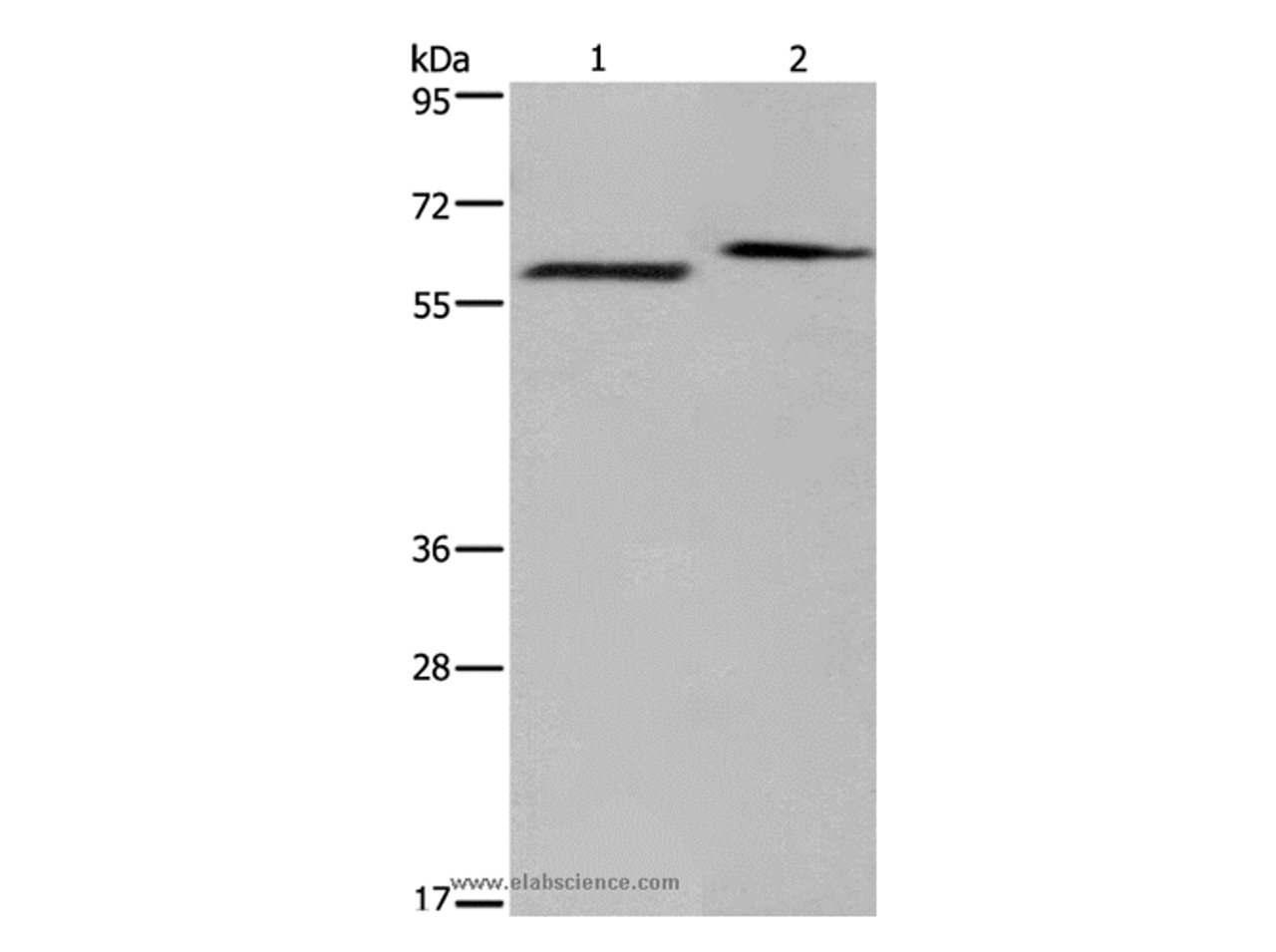 Western Blot analysis of Human fetal brain and Mouse brain tissue using EGR4 Polyclonal Antibody at dilution of 1:400
