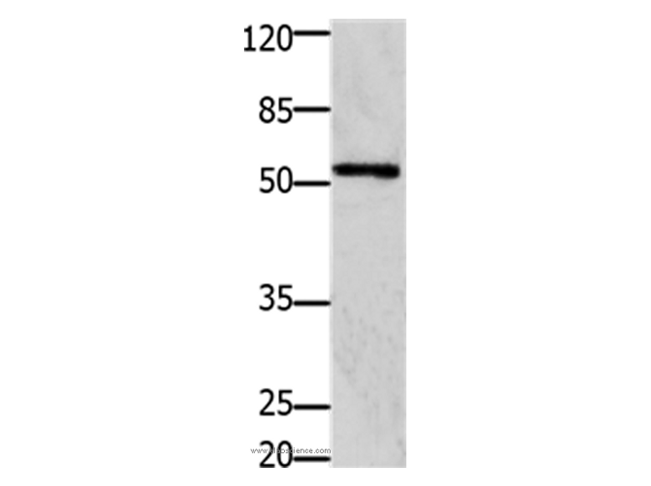 Western Blot analysis of 293T cell using GFRA1 Polyclonal Antibody at dilution of 1:1250