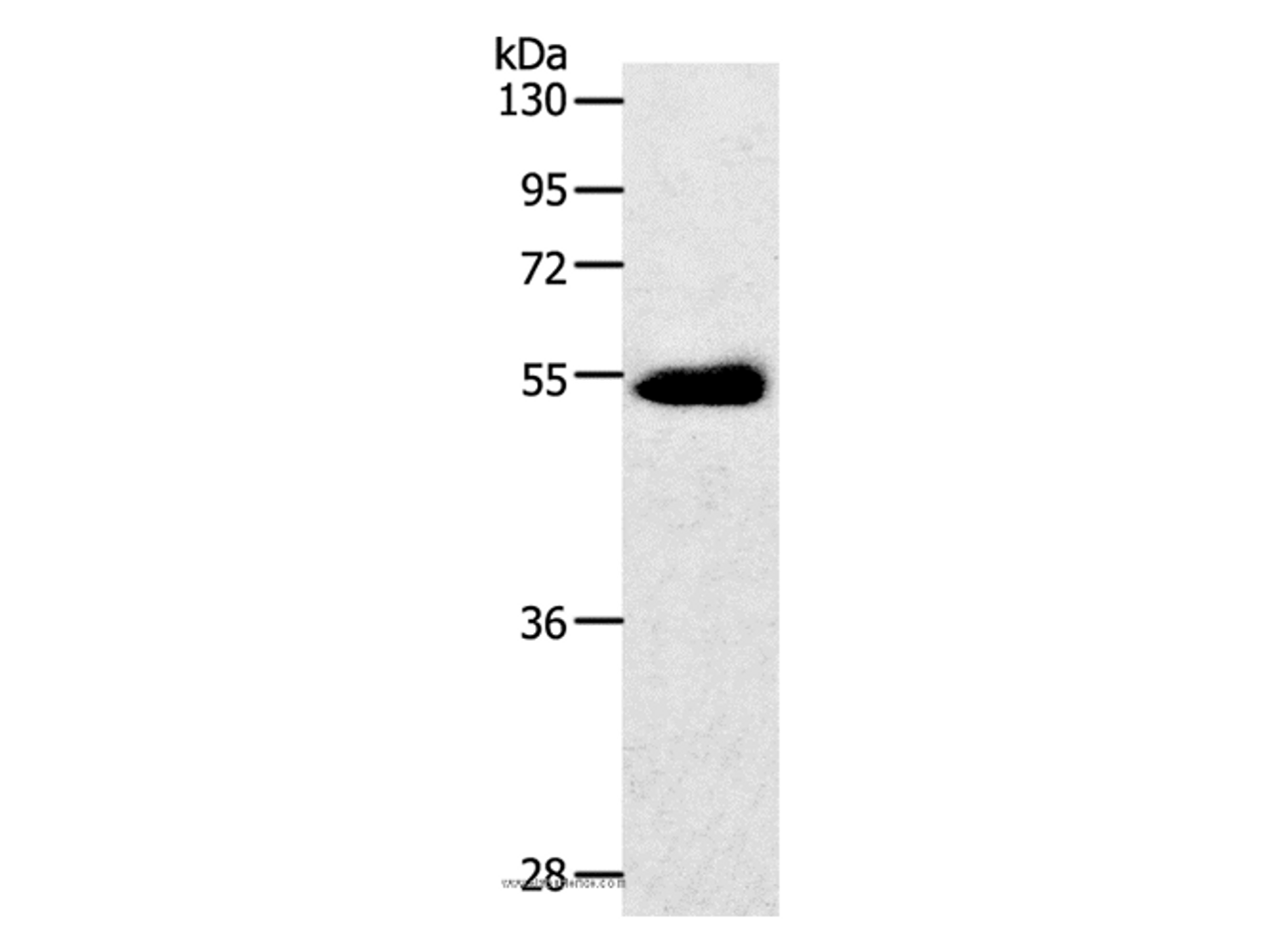 Western Blot analysis of Human colon cancer tissue using GLUT-3 Polyclonal Antibody at dilution of 1:400