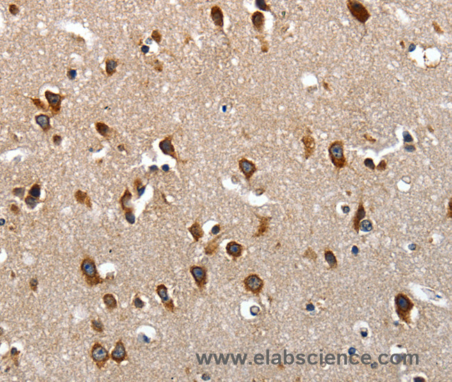 Immunohistochemistry of paraffin-embedded Human brain tissue using LAMA1 Polyclonal Antibody at dilution of 1:70