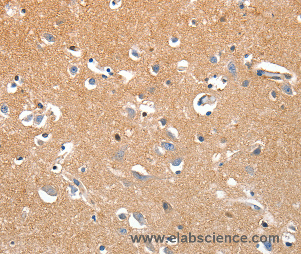 Immunohistochemistry of paraffin-embedded Human brain tissue using LRP3 Polyclonal Antibody at dilution 1:80